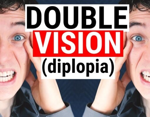 5 Common Causes for Diplopia