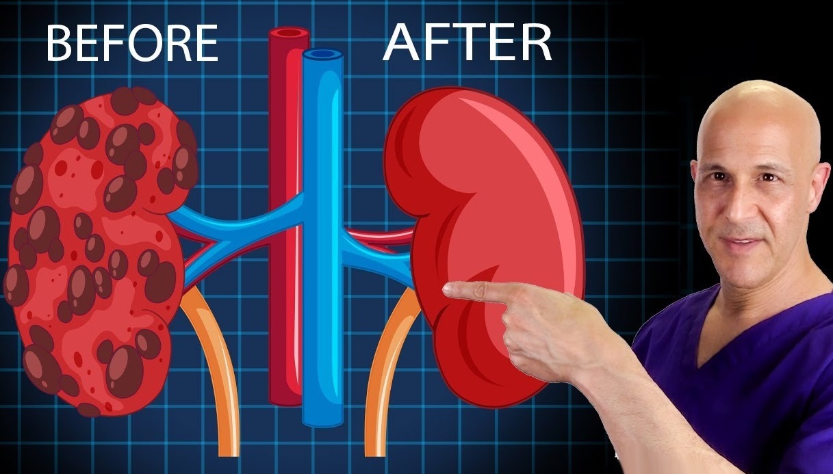 How to Heal & Cleanse Your KIDNEYS