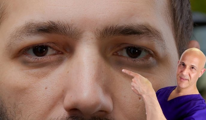 1-vitamin-to-remove-dark-circles