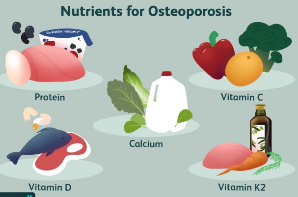 How To Prevent Osteoporosis Naturally
